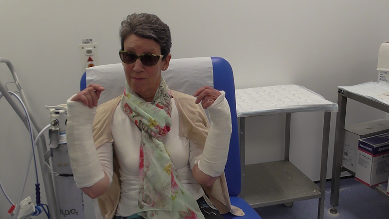 Pauline Rowson - broken wrists 